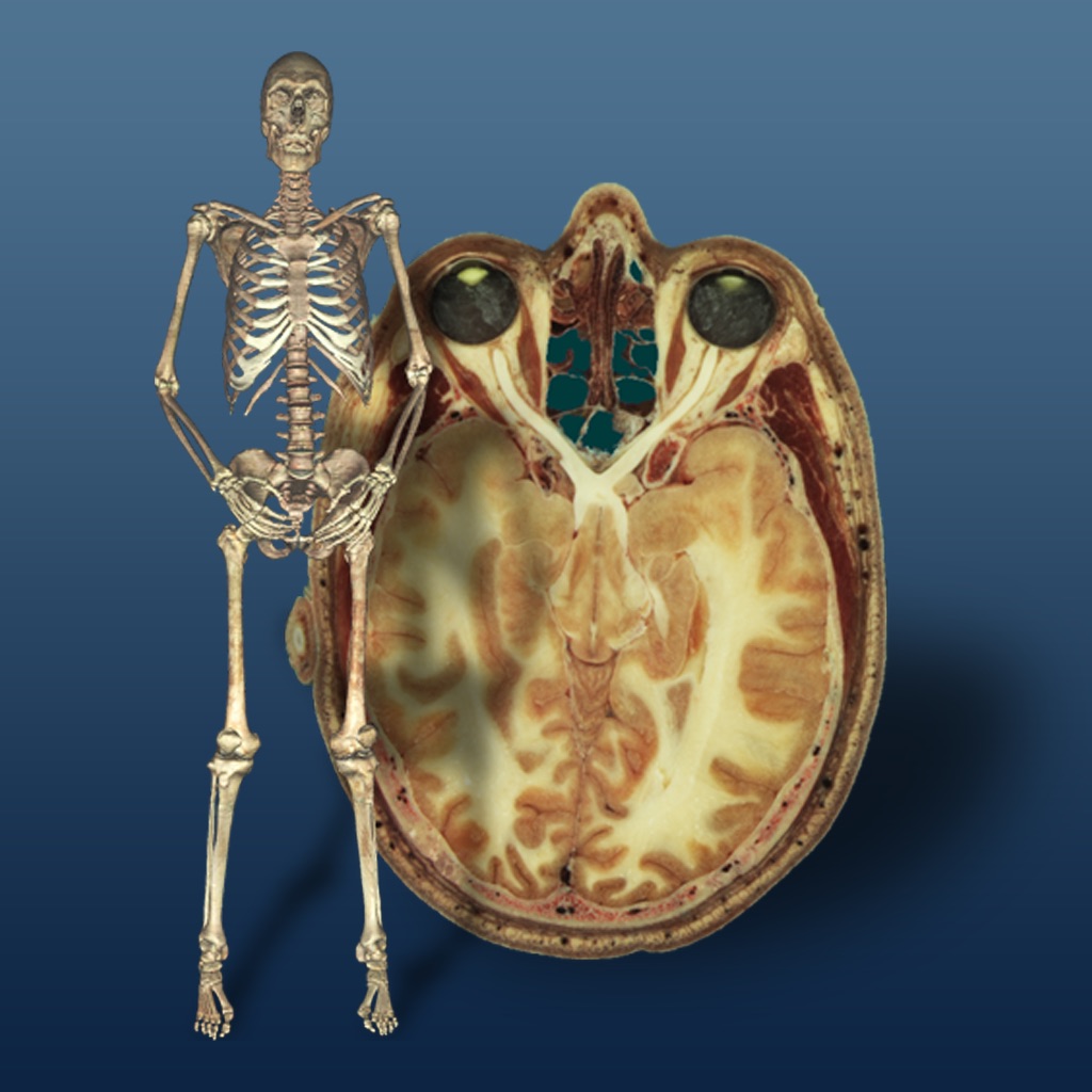 VH Dissector Pro app icon