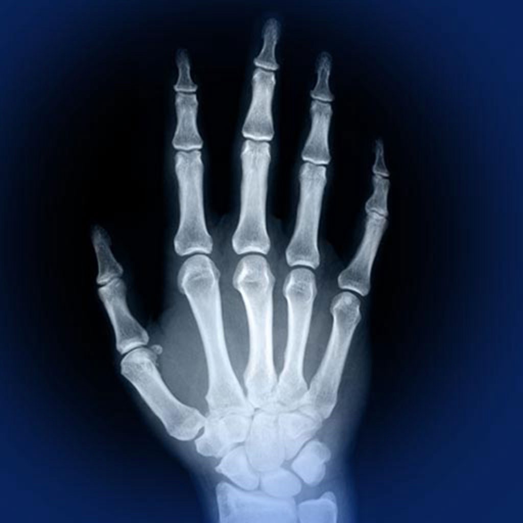 Skeletal Anatomy 3D app icon captured 2026-08-12