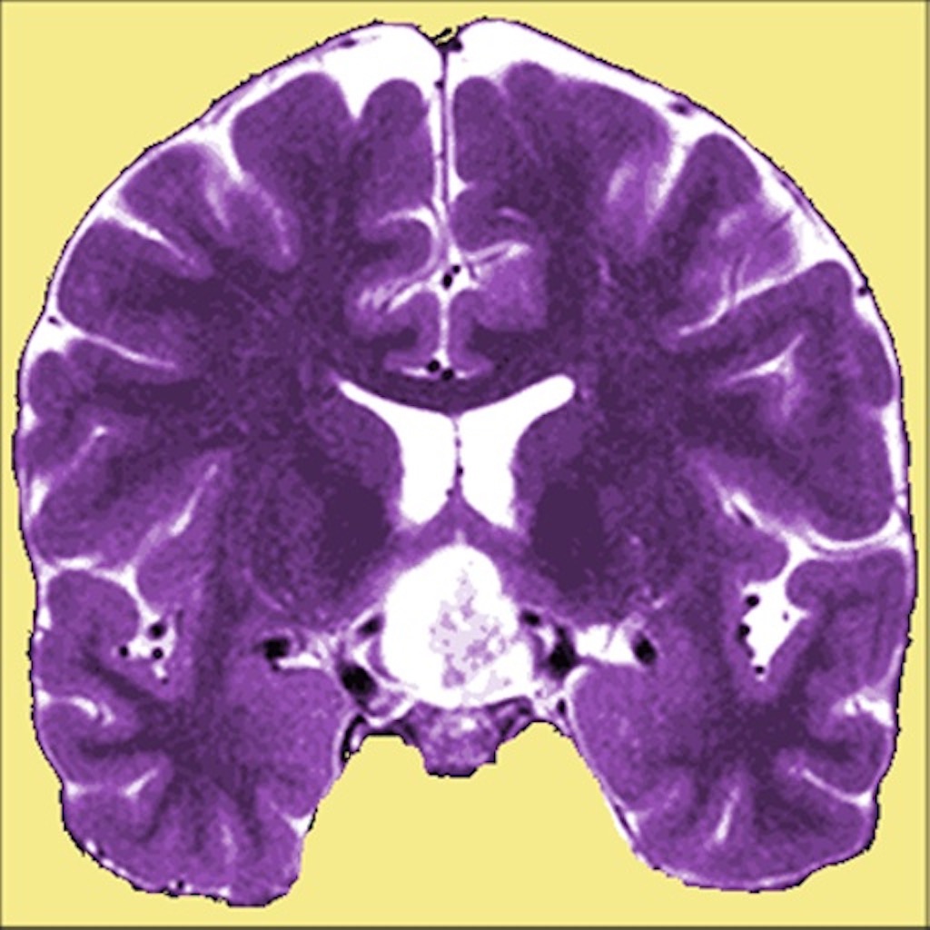 Neuro Toolkit app icon captured 2026-08-11
